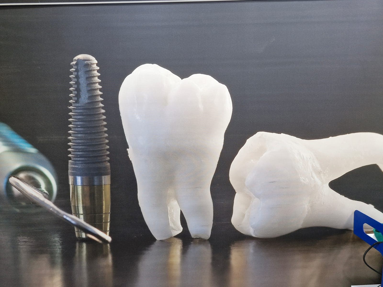 Metal dental implant screw next to two large white model molar teeth on a dark surface.